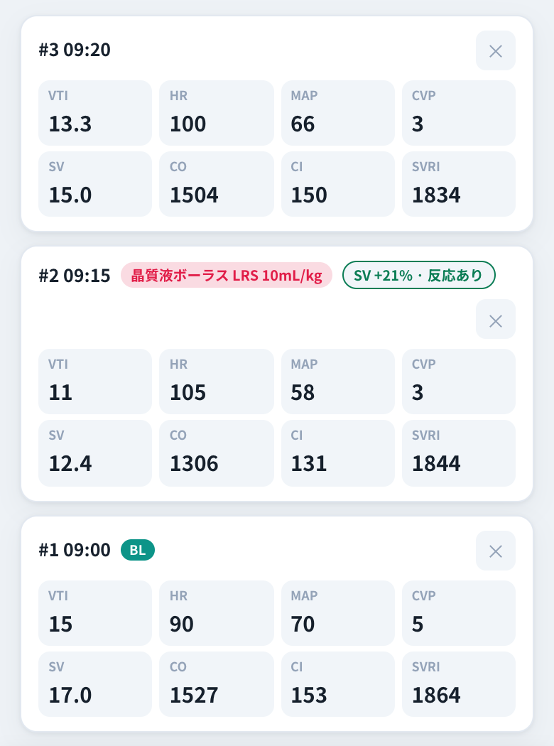 測定履歴。輸液ボーラスの記録に「SV +21%・反応あり」の判定が付いている